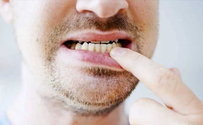 寿命长短，牙齿先知？60岁的人，剩多少颗牙算正常？自查下达标没